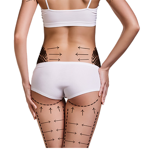 Body Contouring and Liposculpture